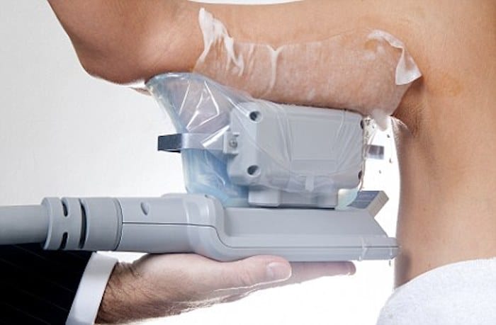 fat freezing arms Lymington