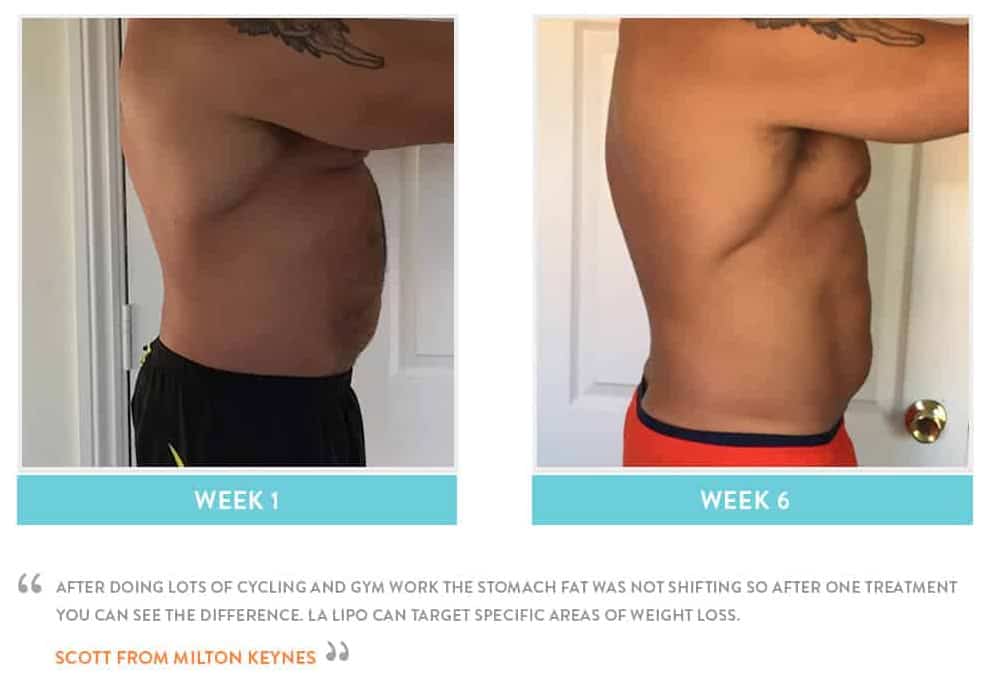 Before & After Stomach Fat Lymington