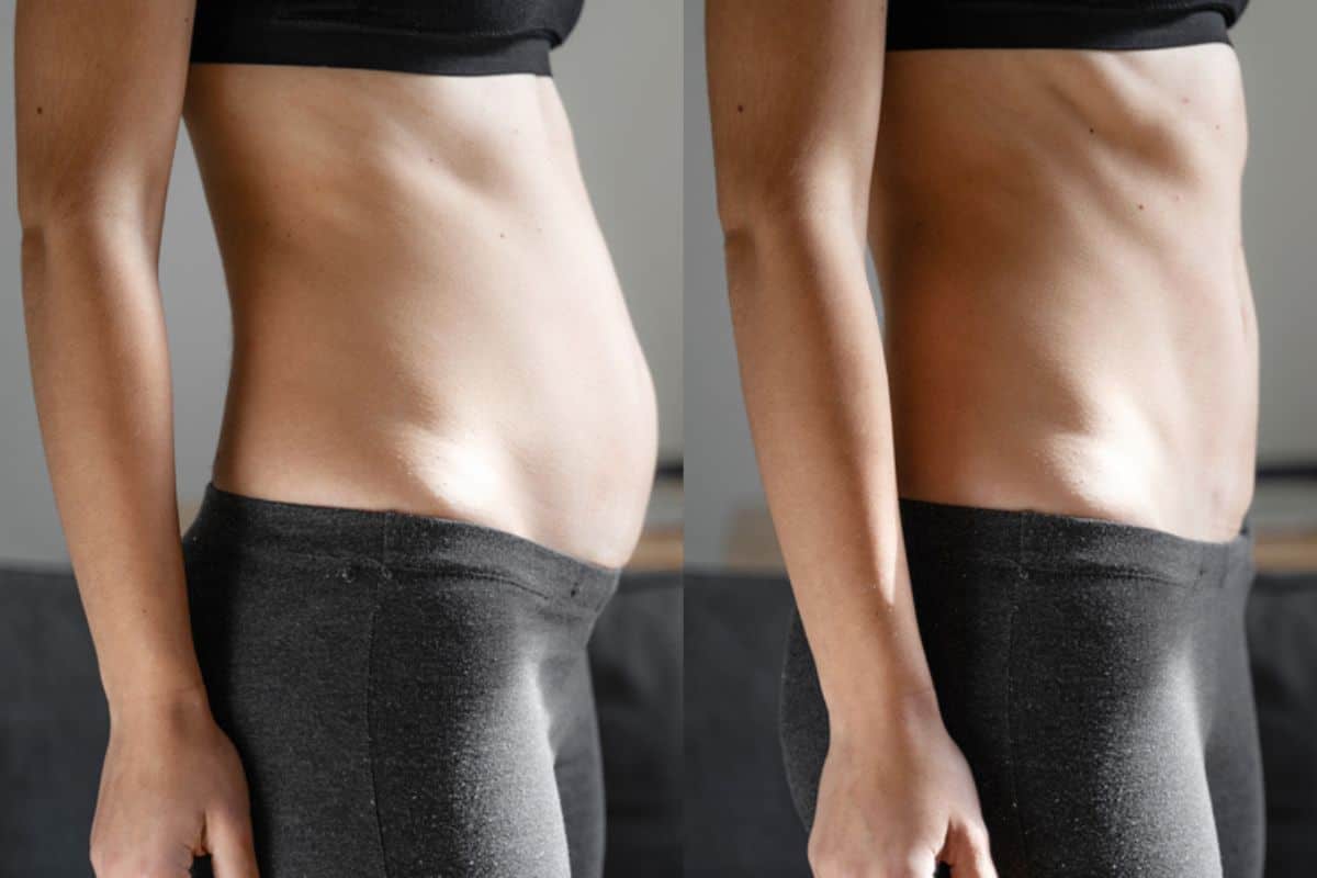 Post-Pregnancy: What Happens to Your Abdominal Muscles After Birth Lymington