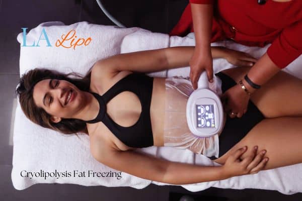 woman getting cryolipolysis Lymington
