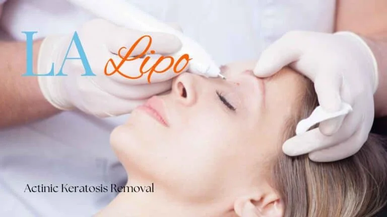 Woman receiving Actinic Keratosis Removal Treatment Lymington