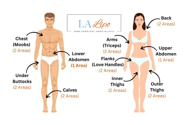 LA LIPO Cryolipolysis Areas Lymington