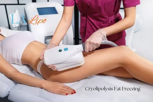 Woman receiving coolsculpting Lymington treatment on her thighs