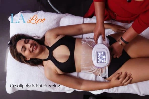 woman getting cryolipolysis Lymington