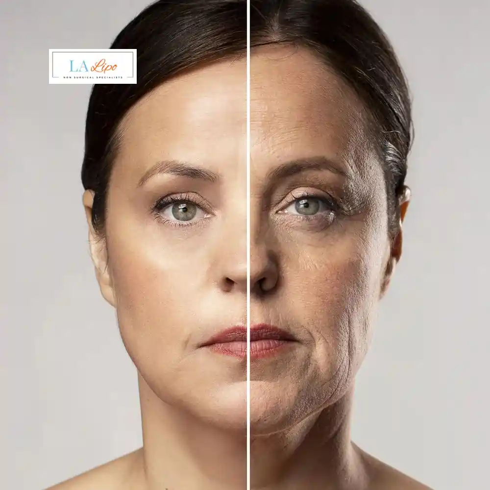 How Can You Tell If Non-Surgical Skin Tightening Is Right for You Lymington?