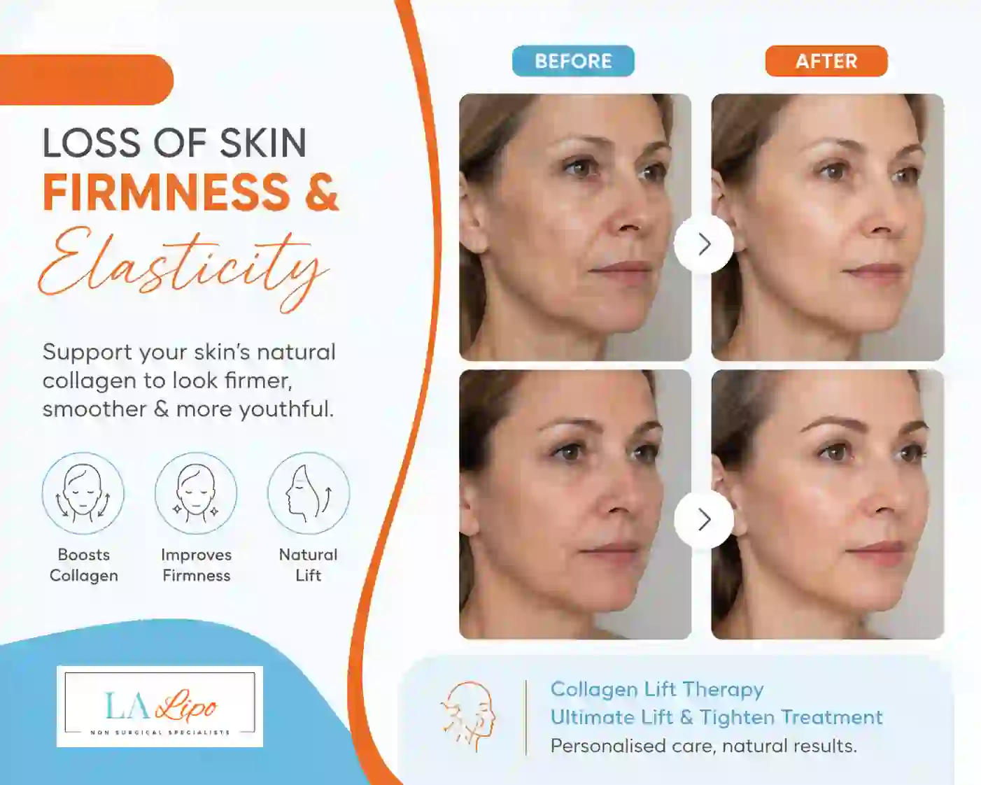 Sign #7: Loss of Skin Firmness and Elasticity Lymington
